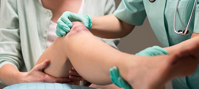 Contusions Treatment Specialist Near Me in Twin Falls, ID Contusions Treatment Specialist Near Me in Twin Falls, ID