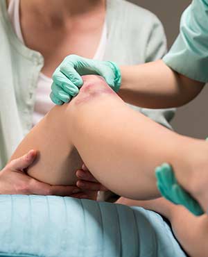 Contusions Treatment Specialist Near Me in Twin Falls, ID