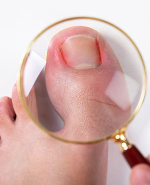 Fingernail and Toenail Injury Treatment Specialist Near Me in Twin Falls, ID