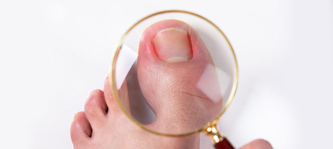 Toenail Doctor Near Me in Twin Falls, ID