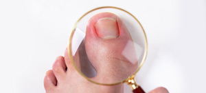 Toenail Doctor Near Me in Twin Falls, ID