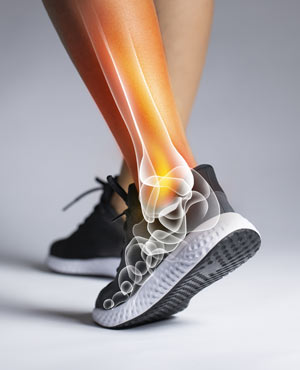 Ankle Sprain Treatment Specialist Near Me In Twin Falls, ID